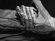 A naturally mummified body (from Guanajuato)
